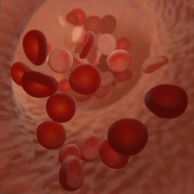 Sickle Cell Anemia