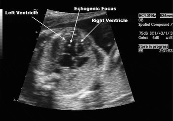 Genetic Sonogram