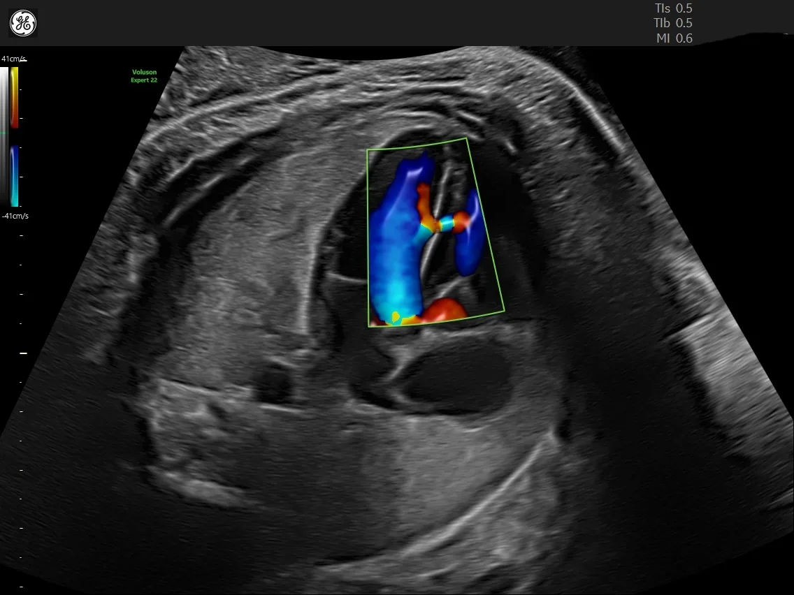 Echocardiography